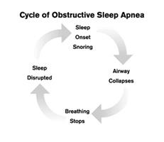 sleep-apnea-cycle
